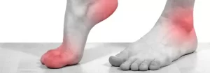 Foot Pain in Huntington NY